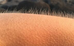 ფრისონი: ესთეტიკური შემცივნება, ფსიქოგენური კანკალი